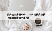 国内检出多例xbb.1.16有结膜炎症状（结膜炎症状严重吗）