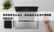 带状疱疹怎么治疗（带状疱疹怎么治疗断根最快的方法）